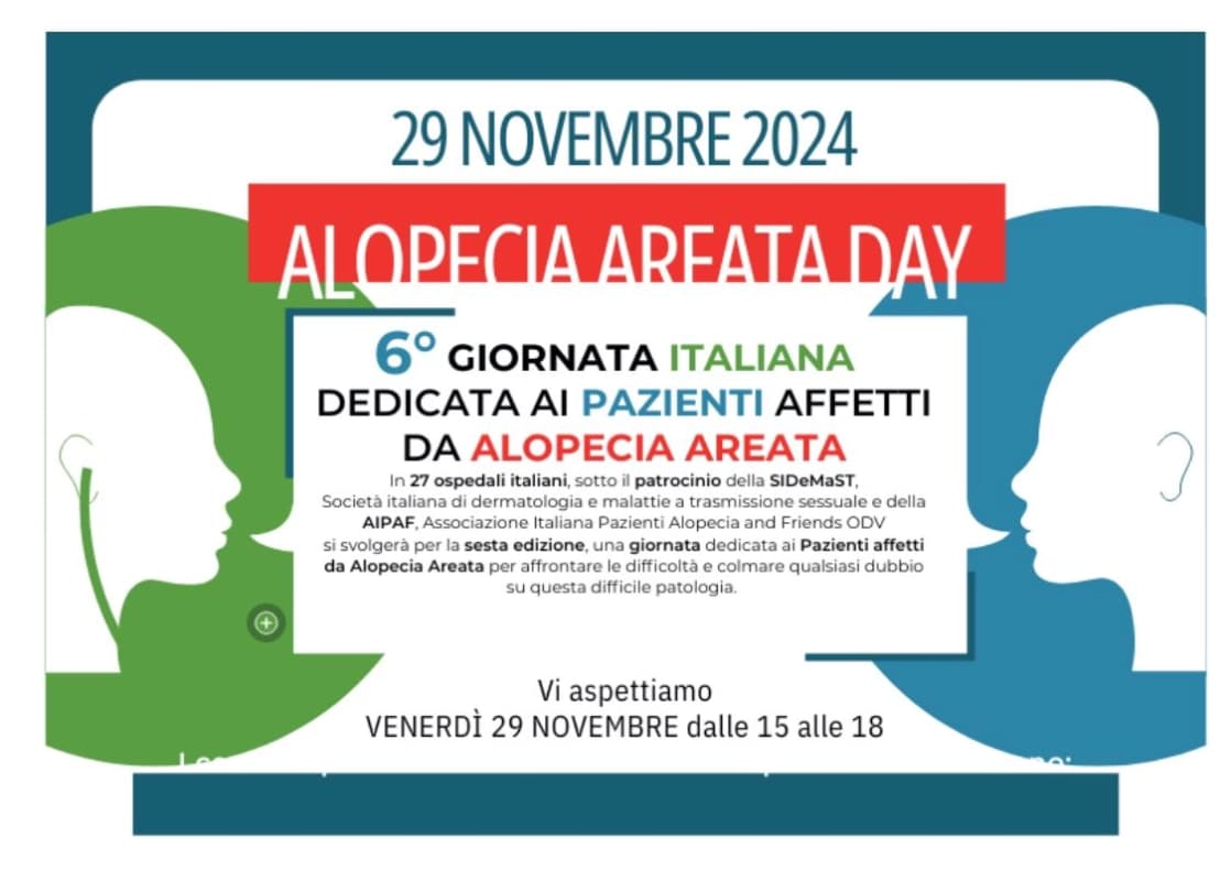 Policlinico Catania: alopecia areata day, venerdi’ 29 visite dermatologiche gratuite negli ambulatori del presidio Rodolico.
