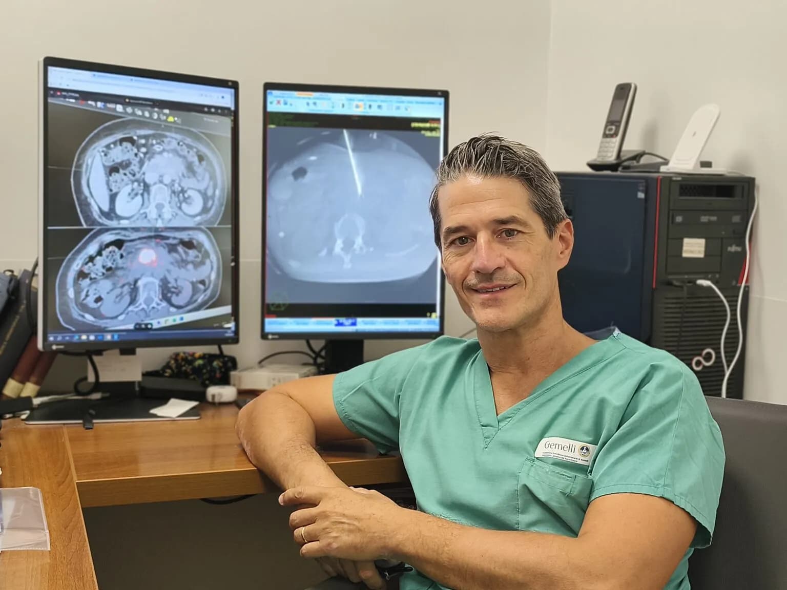 Al Policlinico Gemelli è partita la sperimentazione della “colla” radioattiva per i tumori al pancreas non operabili